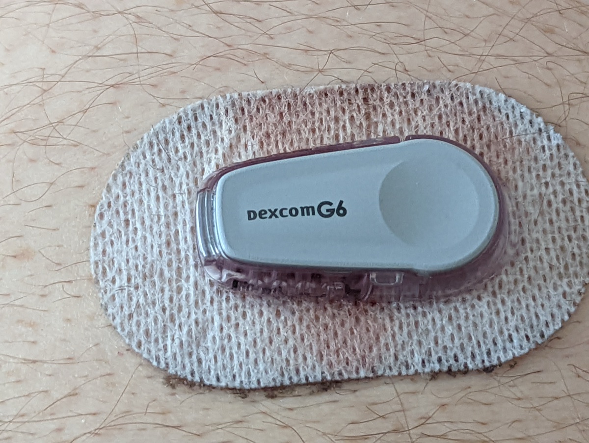 Dexcom CGM trend nyilak megjelenítése — emelkedő és süllyedő irányok
